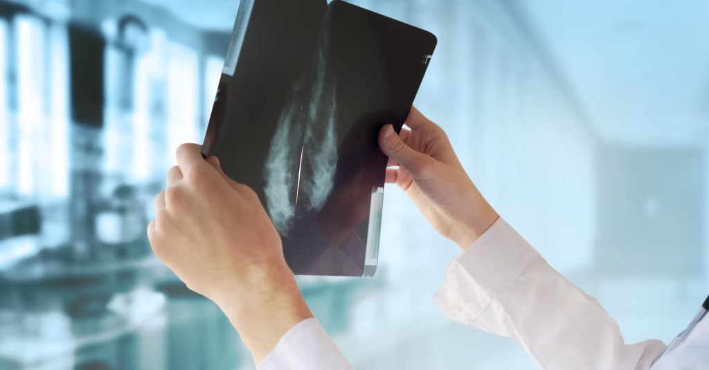 An x-ray is being held up to the light
